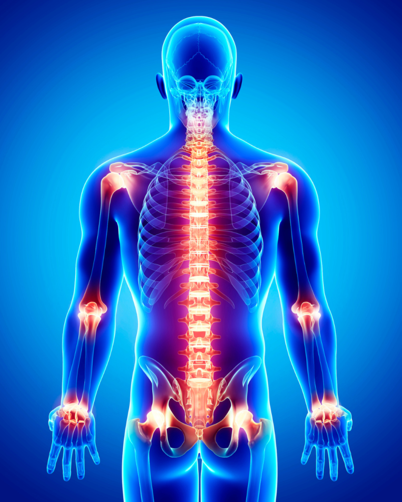 Inflammation & Hormones